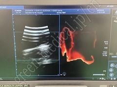 TOSHIBA Diagnostic Ultrasound System