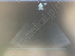GE Healthcare Diagnostic Ultrasound System