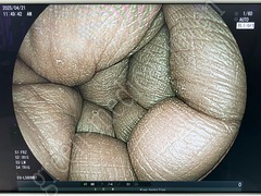 FUJIFILM Video Processor & Laser Lightsource