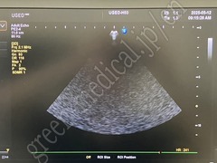 SAMSUNG Ultrasound Color Doppler