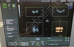 GE Healthcare Portable Ultrasound