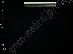 TOSHIBA Ultrasound Color Doppler