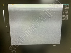 SIEMENS 4D Ultrasound System