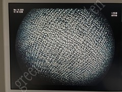 FUJIFILM Transnasal Gastroscope