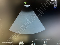 GE Healthcare Diagnostic Ultrasound System