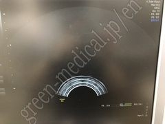 GE Healthcare Diagnostic Ultrasound System