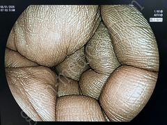 FUJIFILM Processor & Laser Lightsource