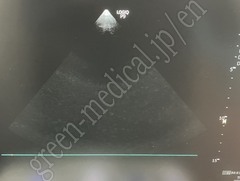 GE Healthcare Diagnostic Ultrasound System