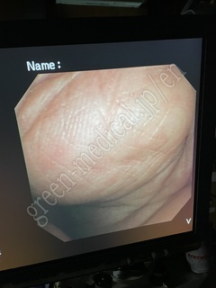 OLYMPUS Video Duodenoscope