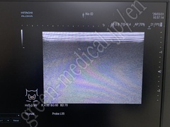 Hitachi Ultrasound Diagnostic System