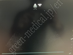 GE Healthcare Diagnostic Ultrasound System