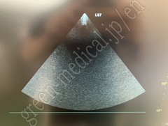 GE Healthcare Ultrasound Color Doppler