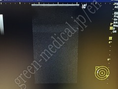 GE Healthcare Ultrasound Color Doppler