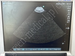 SonoSite Ultrasound Color Doppler