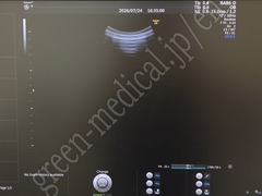 GE Healthcare 4D Ultrasound Color Doppler