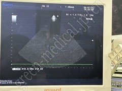 Hitachi Ultrasound Color Doppler