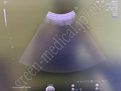 GE Healthcare Diagnostic Ultrasound System