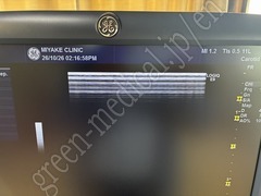 GE Healthcare Ultrasound Color Doppler
