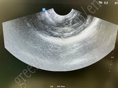 SAMSUNG Ultrasound Color Doppler