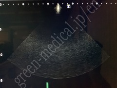 TOSHIBA Ultrasound Color Doppler
