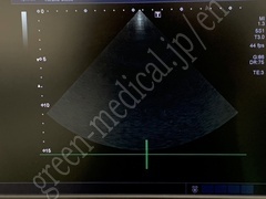 TOSHIBA Ultrasound Color Doppler