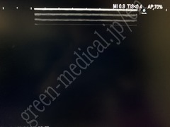 Hitachi Ultrasound Diagnostic System