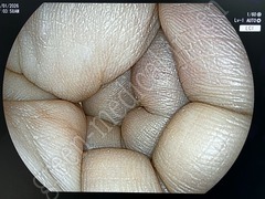 FUJIFILM Processor & Laser Lightsource