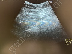 GE Healthcare Diagnostic Ultrasound System