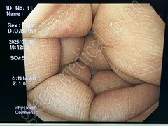 OLYMPUS Video Gastroscope