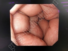 OLYMPUS Processor & Xenon Lightsource