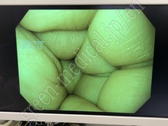OLYMPUS Video Gastroscope