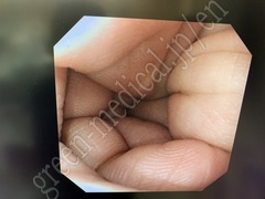 OLYMPUS Video Gastroscope