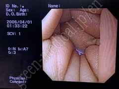 OLYMPUS Processor & Light Source