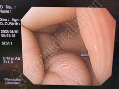 OLYMPUS Video Gastroscope