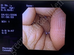 OLYMPUS Video Gastroscope