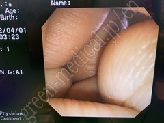 OLYMPUS Video Gastroscope