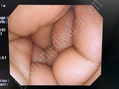 OLYMPUS Processor & Light Source