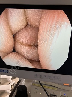 PENTAX Video Processor & Light Source