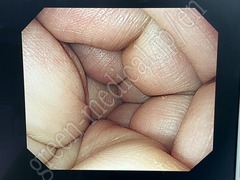 OLYMPUS Processor & Xenon Lightsource