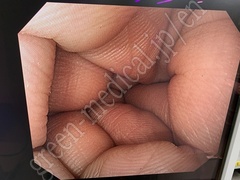 OLYMPUS Video Gastroscope