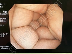 OLYMPUS Video Colonoscope