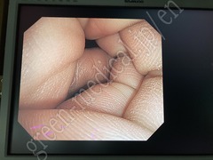 OLYMPUS Video Gastroscope