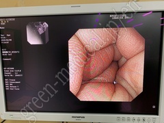 OLYMPUS Processor & Xenon Lightsource