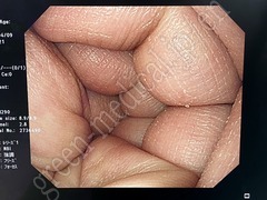 OLYMPUS Processor & Xenon Lightsource