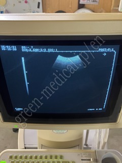 Hitachi Ultrasound