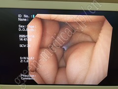 OLYMPUS Video Gastroscope