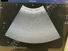 TOSHIBA Ultrasound Color Doppler