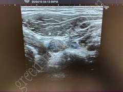 GE Healthcare Diagnostic Ultrasound System