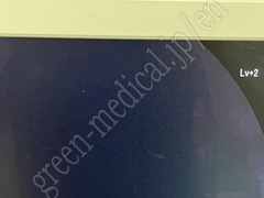 FUJIFILM Video Gastroscope
