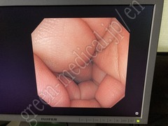 OLYMPUS Video Transnasal Gastroscope